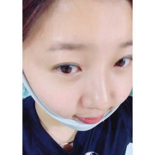 메디미 브이미 업 2스텝 브이라인벨트 — 5점을 준 리뷰어가 2017년 10월 올린 사용 사진