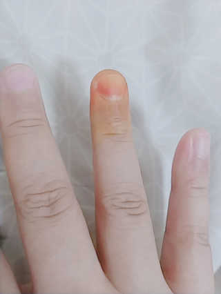 소버스 다이어트 린바디 번앤컷 — 4점을 준 리뷰어가 2019년 9월 올린 사용 사진