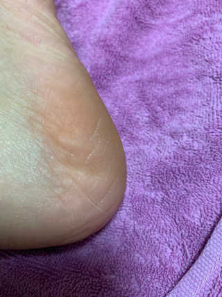 유어비 부탁해 발 부탁해 발 글라스 풋 파일 — 5점을 준 리뷰어가 2019년 4월 올린 사용 사진