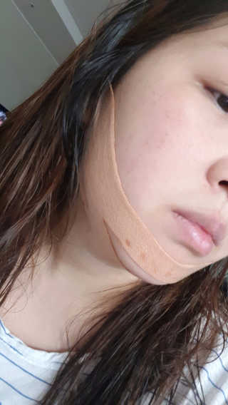아이디플라코스메틱 아이디 페이스핏 마이너스 밴드 — 2.5점을 준 리뷰어가 2019년 10월 올린 사용 사진