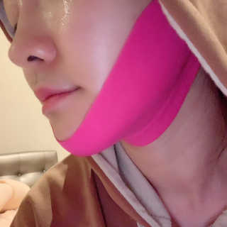 스케덤 펩타이드 리프팅밴드 — 5점을 준 리뷰어가 2019년 3월 올린 사용 사진