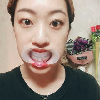라포랩 laforlab 라포랩 화이트줌 치아미백제&개구기 — 3.5점을 준 리뷰어가 2017년 2월 올린 사용 사진