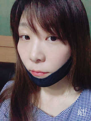 어웨이크어슬립 어슬립 페이스 리프트업 밴드 — 4.17점을 준 리뷰어가 2018년 5월 올린 사용 사진
