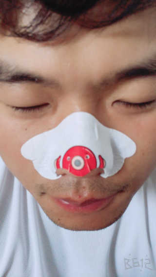 나이팅게일 TAKO PACK NOSE [문어코팩] — 5점을 준 리뷰어가 2017년 5월 올린 사용 사진