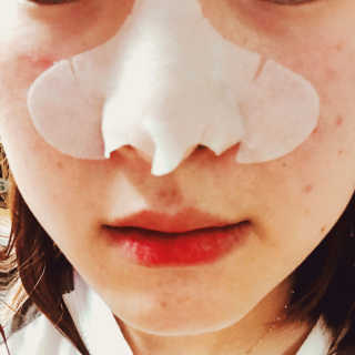 미팩토리 3단 돼지코팩 3매입 X 2 — 5점을 준 리뷰어가 2018년 3월 올린 사용 사진