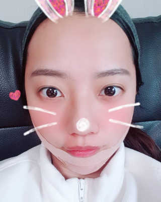아이디플라코스메틱 아이디 페이스핏 마이너스 밴드 — 5점을 준 리뷰어가 2019년 12월 올린 사용 사진