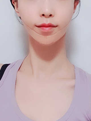아이디플라코스메틱 아이디 페이스핏 마이너스 밴드 — 4점을 준 리뷰어가 2019년 10월 올린 사용 사진
