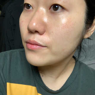 메디필 에스테 더마 레드마린 콜라겐 토너 — 5점을 준 리뷰어가 2020년 1월 올린 사용 사진