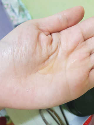 세포랩 바이오제닉 에센스 30ml 특별팩 — 4점을 준 리뷰어가 2018년 5월 올린 사용 사진