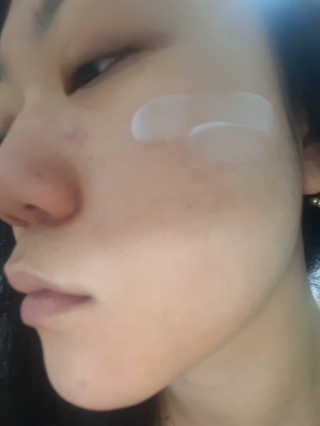 나이팅게일 티타민 크림 리뉴얼 — 5점을 준 리뷰어가 2018년 5월 올린 사용 사진