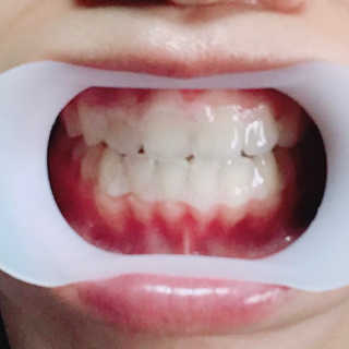 안뇽안뇽님이 올린 리뷰 사진 3