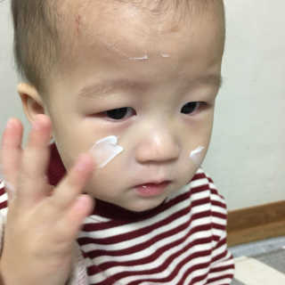 벨보이 스튜디오 벨보이스튜디오 케어젠 수딩 더마크림 — 4.5점을 준 리뷰어가 2017년 2월 올린 사용 사진