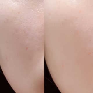 파시스 올인원 진주 화이트닝 크림 100ml — 5점을 준 리뷰어가 2019년 3월 올린 사용 사진