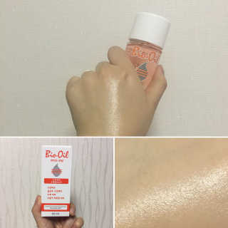 Bio-oil(바이오오일) 바이오오일(Bio-oil) — 3.5점을 준 리뷰어가 2017년 1월 올린 사용 사진
