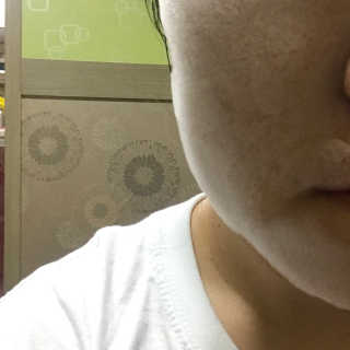 셀퓨전씨 트리악 포어 딜리트 버블 팩 — 3.5점을 준 리뷰어가 2018년 4월 올린 사용 사진