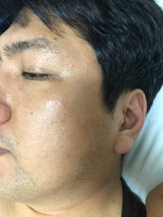 비니주니맘 :D님이 올린 리뷰 사진 1