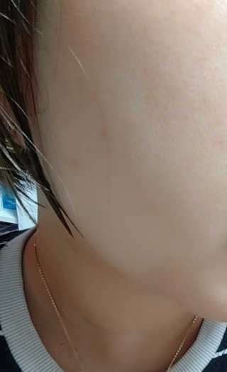온가족 수분뿜뿜 노랑뚜껑 재주꾼 와우374 스네일토너 — 5점을 준 리뷰어가 2019년 9월 올린 사용 사진