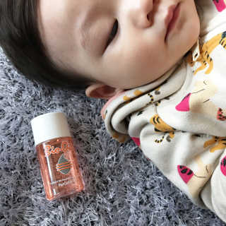 Bio-oil(바이오오일) 바이오오일(Bio-oil) — 4.5점을 준 리뷰어가 2016년 12월 올린 사용 사진