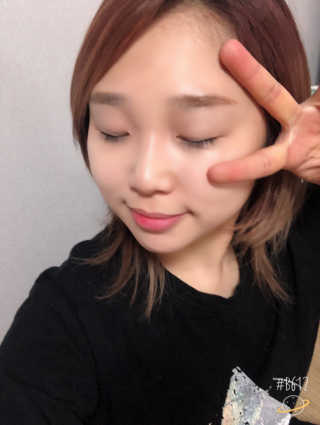 나이팅게일 티타민 크림 리뉴얼 — 5점을 준 리뷰어가 2018년 4월 올린 사용 사진