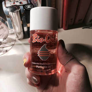 Bio-oil(바이오오일) 바이오오일(Bio-oil) — 3.5점을 준 리뷰어가 2017년 2월 올린 사용 사진