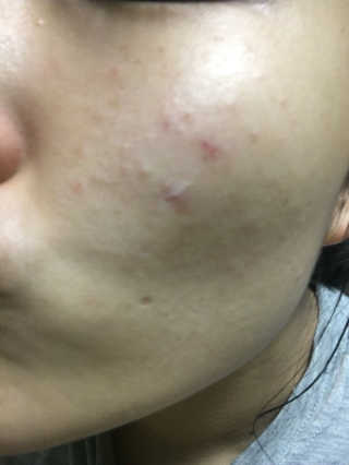 23years old 바데카실P — 4.5점을 준 리뷰어가 2016년 11월 올린 사용 사진