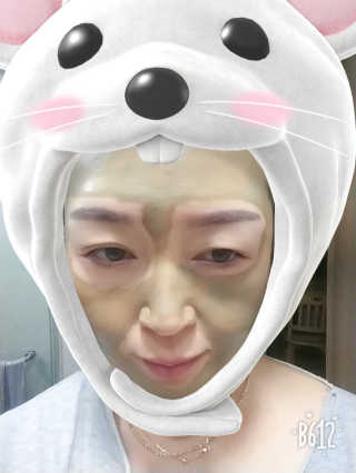 플러스셀라 시카골드 클렌징바 화산재팩 세트 — 4점을 준 리뷰어가 2020년 1월 올린 사용 사진