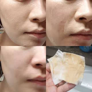 [더메디닥터] 글리셜 미셀라 클렌징 워터 — 5점을 준 리뷰어가 2019년 4월 올린 사용 사진