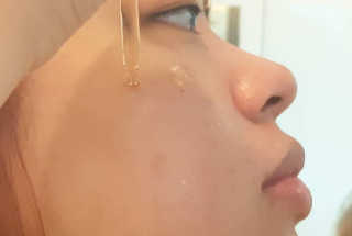 센텐스 블랙사피르 프로폴리스 팅크처 페이셜 앰플 — 5점을 준 리뷰어가 2019년 10월 올린 사용 사진