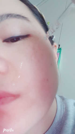 어니시 닥터에이 99앰플 세트 10ml X 5개 — 4.5점을 준 리뷰어가 2019년 4월 올린 사용 사진