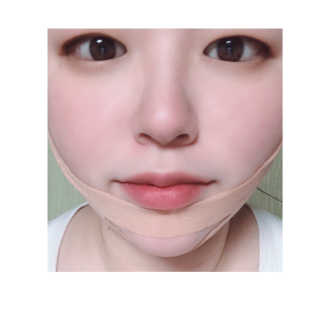 아이디플라코스메틱 아이디 페이스핏 마이너스 밴드 — 5점을 준 리뷰어가 2019년 10월 올린 사용 사진