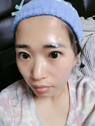 메디타임 멜라반 더마 토닝 씬젤 — 3.5점을 준 리뷰어가 2019년 5월 올린 사용 사진
