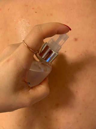 dr.eslee 안티세범 백크네 스프레이 — 5점을 준 리뷰어가 2019년 5월 올린 사용 사진