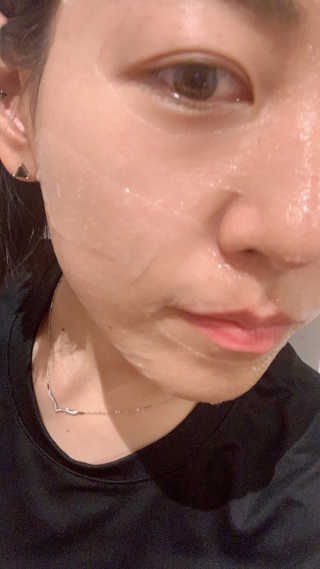 메디타임 멜라반 더마 토닝 씬젤 — 5점을 준 리뷰어가 2019년 6월 올린 사용 사진
