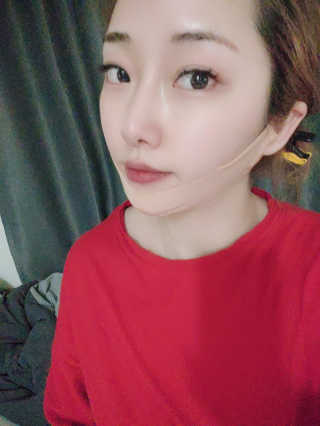 아이디플라코스메틱 아이디 페이스핏 마이너스 밴드 — 5점을 준 리뷰어가 2020년 2월 올린 사용 사진