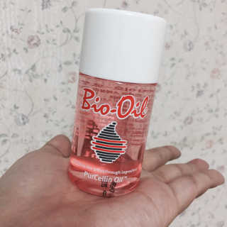 Bio-oil(바이오오일) 바이오오일 — 4.5점을 준 리뷰어가 2016년 10월 올린 사용 사진