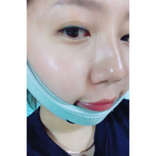 메디미 브이미 업 2스텝 브이라인벨트 — 5점을 준 리뷰어가 2017년 10월 올린 사용 사진
