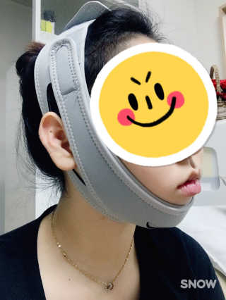 메디미 브이미 업 2스텝 브이라인벨트 — 5점을 준 리뷰어가 2017년 5월 올린 사용 사진