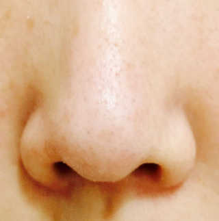 나이팅게일 TAKO PACK NOSE [문어코팩] — 5점을 준 리뷰어가 2017년 5월 올린 사용 사진