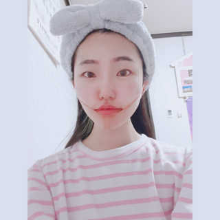 아이디플라코스메틱 아이디 페이스핏 마이너스 밴드 — 4.5점을 준 리뷰어가 2020년 3월 올린 사용 사진