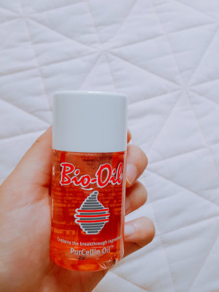 Bio-oil(바이오오일) 바이오오일(Bio-oil) — 3.5점을 준 리뷰어가 2016년 8월 올린 사용 사진