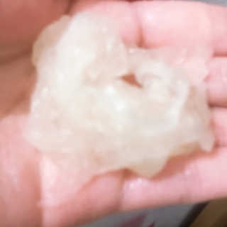 메디타임 멜라반 더마 토닝 씬젤 — 5점을 준 리뷰어가 2019년 6월 올린 사용 사진