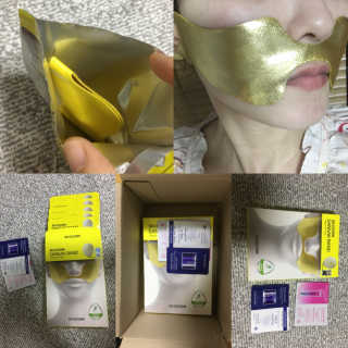 [스케덤] 상악밴드 — 4점을 준 리뷰어가 2019년 5월 올린 사용 사진