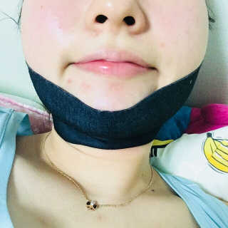 어웨이크어슬립 어슬립 페이스 리프트업 밴드 — 5점을 준 리뷰어가 2018년 5월 올린 사용 사진