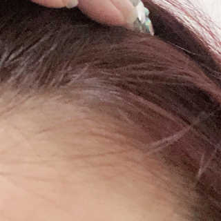 바로티나 [리뷰 상품권 이벤트] 즉시 굵어지는 헤어볼륨S — 4.5점을 준 리뷰어가 2019년 10월 올린 사용 사진