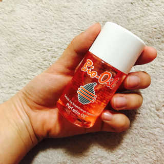 Bio-oil(바이오오일) 바이오오일(Bio-oil) — 4.5점을 준 리뷰어가 2017년 1월 올린 사용 사진