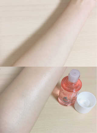 Bio-oil(바이오오일) 바이오오일 — 4.5점을 준 리뷰어가 2016년 10월 올린 사용 사진