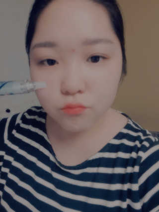23years old 바데카실 프로 엑스퍼트 앰플 — 5점을 준 리뷰어가 2018년 10월 올린 사용 사진