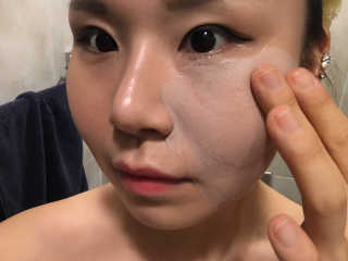 셀퓨전씨 트리악 포어 딜리트 버블 팩 — 4.67점을 준 리뷰어가 2018년 4월 올린 사용 사진