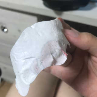 나이팅게일 TAKO PACK NOSE [문어코팩] — 4.5점을 준 리뷰어가 2018년 5월 올린 사용 사진