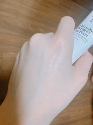 리스킨 [TS]센텔라스카연고 — 4점을 준 리뷰어가 2019년 1월 올린 사용 사진